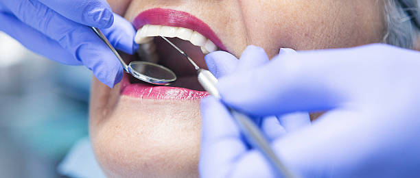 Best Emergency Tooth Extraction in Forestville, CA